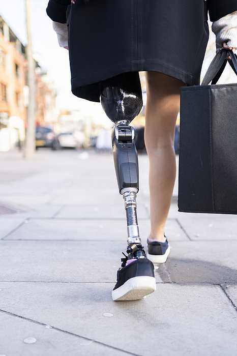 Low section of woman with leg prosthesis walking in the city Photograph by Westend61