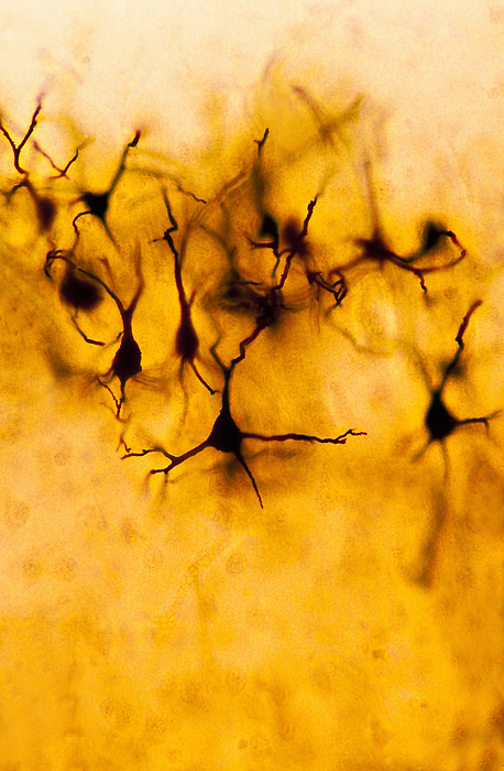Neurons (Pyramidal Cells), Cerebral Cortex (Magnification x100) Shows: neurons, cell bodies, and numerous nerve fibres that are mostly dendrites. Fox-Golgi stain. Photograph by Ed Reschke Neurons (Pyramidal Cells), Cerebral Cortex (Magnification x100) Shows: neurons, cell bodies, and numerous nerve fibres that are mostly dendrites. Fox-Golgi stain. Photograph by Ed Reschke