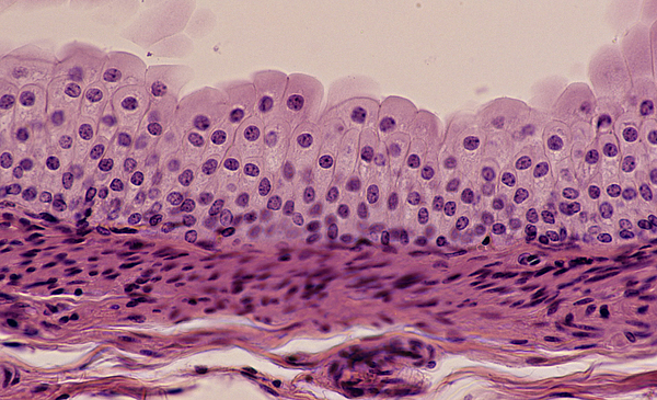 TRANSITIONAL EPITHELIUM, URETER, 100X Shows: many cell layers, cells near the surface that are pear-shaped, supporting connective below. Unstretched state. Also, found in the bladder. Photograph by Ed Reschke TRANSITIONAL EPITHELIUM, URETER, 100X Shows: many cell layers, cells near the surface that are pear-shaped, supporting connective below. Unstretched state. Also, found in the bladder. Photograph by Ed Reschke